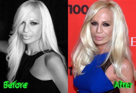 donatella versace son age|Donatella Versace before plastic surgery.